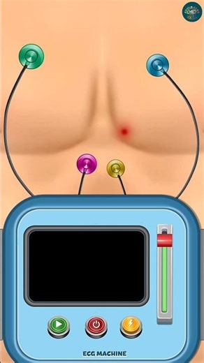 Extreme ECG ASMR ❤️ | Heart Checkup Animation | Oddly Satisfying Medical ASMR #shorts #asmr #ecg