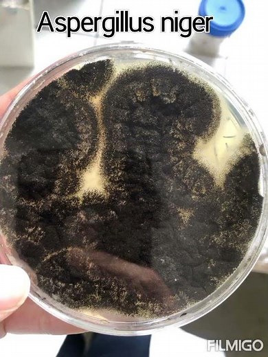 Aspergillus niger fungus growth on sabouraud dextrose agar (SDA)