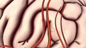 Atherosclerotic cardiovascular disease and stroke