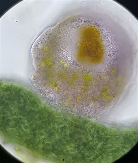 Amateur Microscopy | Found this today | Facebook