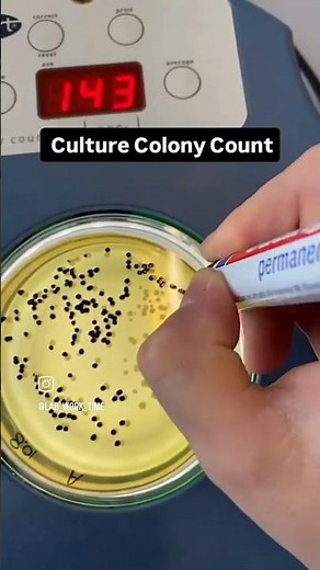 How to Count Bacterial Colonies | Microbiology Basics