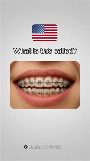 Learn Dental English Vocabulary