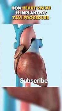 How This 3D Animation is Saving Lives #medical animation