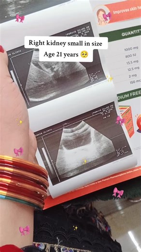 #foryoupage❤️❤️ #Comment #med #viralll #foryoupage❤️❤️