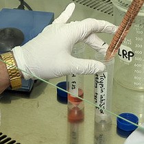 Video: Cell Sorting of Neural Stem and Progenitor Cells from the Adult Mouse Subventricular Zone and Live-imaging of their Cell Cycle Dynamics