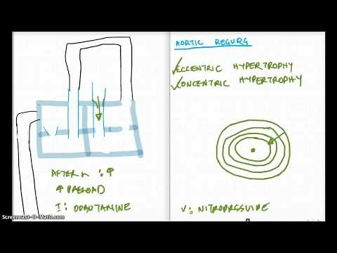 AR, AS, ECCENTRIC VS CONCENTRIC HYPERTROPHY