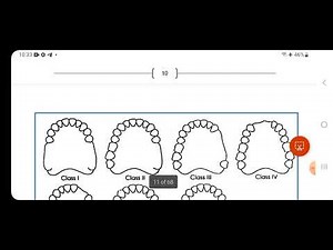 Introduction to partial denture ‪@dr.daliaahmed6410‬