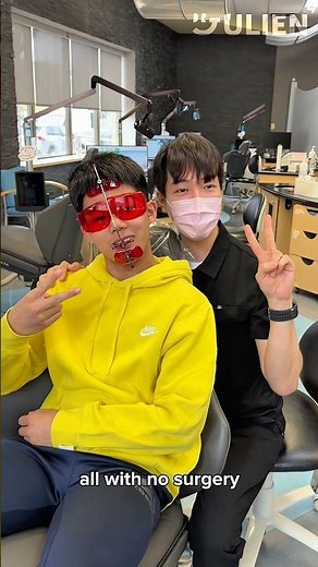 How Facemask Corrects Your Underbite with NO Surgery #braces