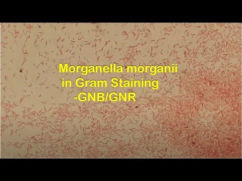 Gram Negative Rods of Morganella morganii in Gram Staining