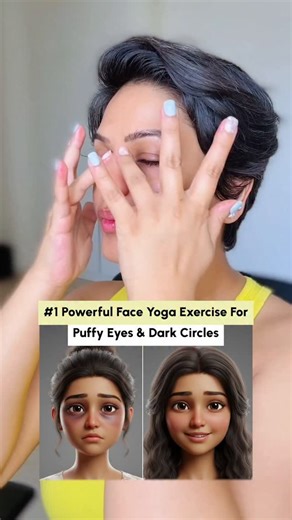 Garima✨India's First Facial Reflexology x Face Yoga Expert on Instagram: "Dark circles and puffy eyes? It’s NOT just about late nights, there’s more to the story 👀 Q: Why do I have dark circles under my eyes? A: Multiple causes, genetics, pigmentation, thinning skin, and visible blood vessels through delicate skin. Q: Are dark circles permanent? A: They can persist if they stem from genetics or bone structure, but many are reversible with lifestyle changes and proper care. Q: What causes under-