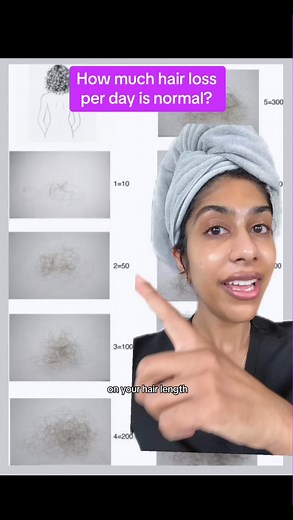 Dr. Neera Nathan on Instagram: "Are you losing too much hair? Here’s how to know and what to do about it: As a dermatologist with hair loss, I wish I would have known what normal versus abnormal hair shedding looked like YEARS ago. It is completely normal to lose between 50-200 hairs per day. Keep in mind that number is based on daily hair washing, so if you go longer between washes, you may see more hair on the shower floor. If you are losing more than 400 hairs per day, I recommend seeking car