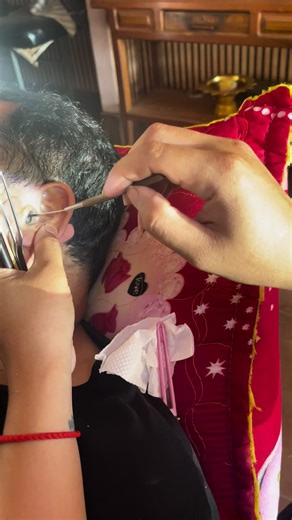 #ear #cleaning #waxear #removal