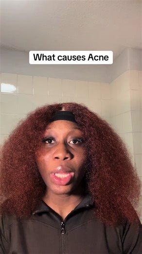 Skincare with Ose Day 14 #fyp #skincare #acne