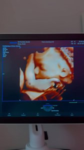 2.5K views · 22 reactions | Peek A Bootique 5D: Come to work with me! A little behind the scenes of a day in my life at @peekabootique5d!  Love meeting every single one of you, your babies, while valuing the friendships/memories we create! 﫶 Book an appointment to enjoy viewing your baby’s life in the womb with family/friends, and sharing these precious moments! ✨ Book online at PEEKABOOTIQUE5D.com or give us a call at (313) 634-3400. | Metro Detroit News | Facebook