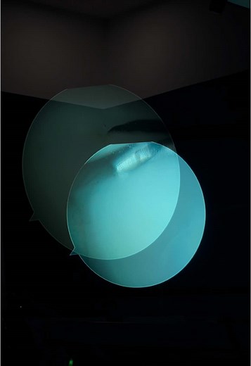 #knee #traumatologoenmonterrey #rodilla #monterreynuevoleon #drgonzalezbazaldua #2025