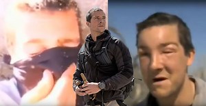 Watch: Bear Grylls rushes for aid after savage allergic reaction to bee sting - Extra.ie