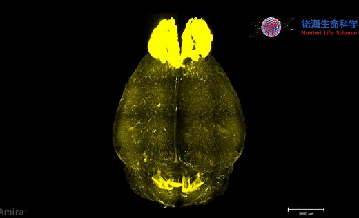 小鼠全脑血管染色及成像