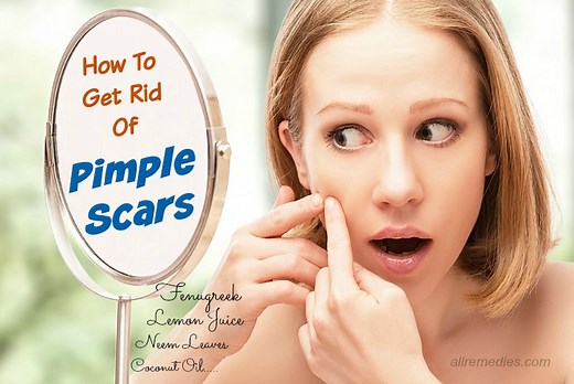 How To Get Rid Of Pimple Scars Naturally: 20 Fast Tips