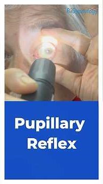 Pupillary Reflex
