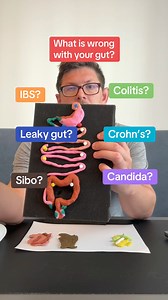 1.5K views · 20 reactions | Poop map - What gut disease do you have? Heal your gut with my webinar: https://www.healyourgutguy.com/get-webinar . . | Heal Your Gut Guy | Facebook