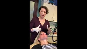Using the Vbeam Laser to Treat Rosacea