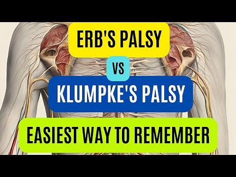 Erb's Palsy Vs Klumpke's Palsy | Brachial Plexus Injury | Easy Way To Remember