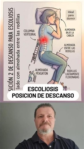 🌿 ¿POR QUÉ LA POSICIÓN DE LADO CON ALMOHADA ENTRE LAS RODILLAS PUEDE AYUDAR EN LA ESCOLIOSIS?