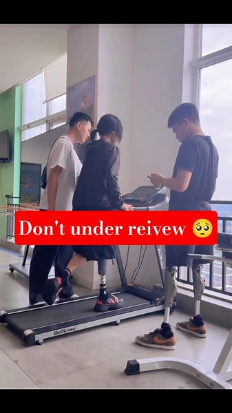 Amazing Prosthetic Leg Walking Skills | Real Life Prosthetic User