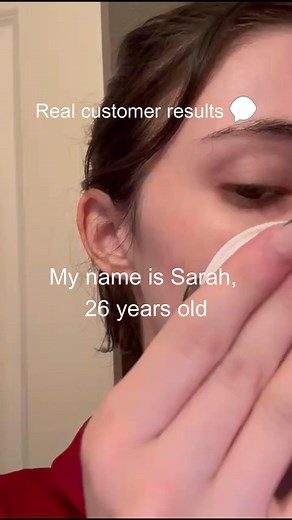 See this?  One night difference using our Zit-Zapping Patch. No harsh ingredients, no drama—just clear, calm skin while you sleep. Try it yourself! | Zitscancelled | Facebook