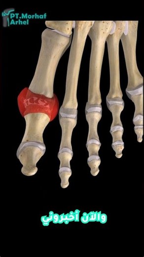 #Xposed #لكي_تعرف_جسمك_أكثرلطالما تسائلنا: ما هو النقرس Gout وكيف يحدث؟