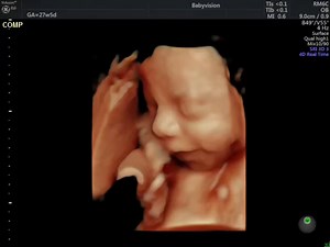 6.4K views · 56 reactions | Babyvision scans from 6 weeks Our early scans check for baby's heartbeat, how many babies there are and that baby is in the correct place. This is what you can expect to see on a scan at 6 weeks 5 days and this baby measures 8mm (about the size of a baked bean). The early scans are available Monday-Saturday and are £75 with a full report, images and pregnancy information book. | Babyvision | Facebook