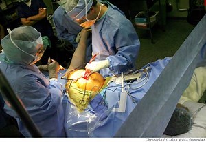 Shaving hips instead of replacing them gives patients more running time