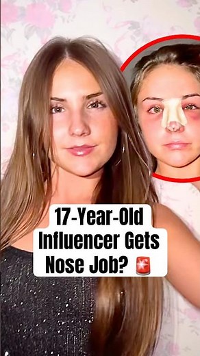17-Year-Old Influencer Gets Nose Job? #shorts #piperrockelle #surgery