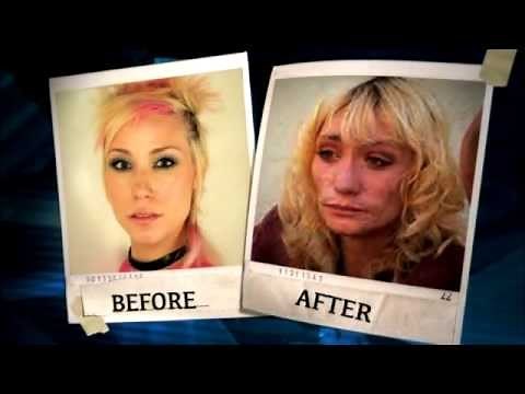 A Sobering Look at What Meth Can Do to Your Appearance