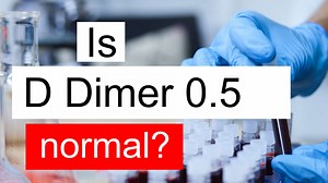 Is D Dimer 0.5 normal, high or low? What does D Dimer level 0.5 mean?