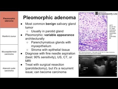 Salivary Gland Neoplasms