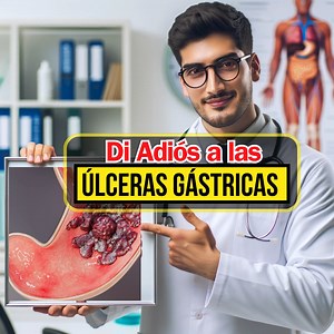 🌿🍵 ¿Sufres de úlceras gástricas? No te pierdas este video: 'Di Adiós a las Úlceras Gástricas: Descubre los 5 Mejores Remedios Caseros'. Aquí exploraremos tratamientos naturales que han demostrado ser efectivos en la lucha contra este molesto problema. Descubrirán: 1. Jugo de Col: Un remedio antiguo pero sorprendentemente eficaz 🥬 2. Ajo: Con sus poderosas propiedades antimicrobianas y antibacterianas 🧄 3. Cúrcuma: La curcumina como un potente agente terapéutico 🌼 4. Miel: No solo dulce, sin