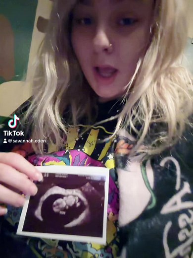 Mommy’s little bean❤️ #fyp #pregnant