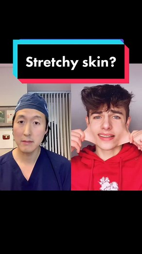 Super Stretchy Skin: Understanding Ehlers Danlos Syndrome