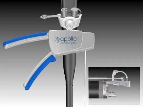 OverStitch™ Animation - Device Assembly