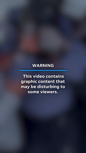 Video captured a skier being rescued after she was attacked by a wild snow leopard in China. | azcentral