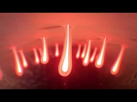 How It Works - DermRays Diode Laser Hair Removal Devices