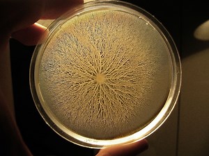 What plates are used to grow bacteria? [2025] | QAQooking.wiki