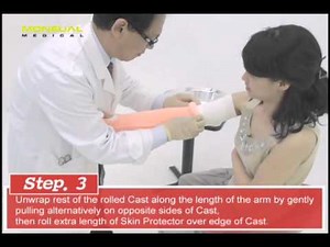 Long Arm Cast Application