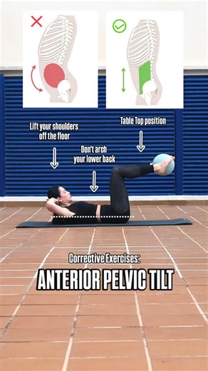 Anterior pelvic tilt is a postural pattern where the pelvis rotates forward, increasing the lumbar curve and placing extra stress on the lower back. It is commonly associated with muscle imbalances and poor lumbopelvic control, affecting posture, movement efficiency, and long-term spinal health. Be Healthy!💜 - - #anteriorpelvictilt #correctiveexercises #posturecorrection #violetbalance #lumbopelvicstability | Violet Balance