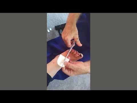 Instruction on how to use our 5mm Felt Chiropody Padding