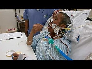 ECMO動画4