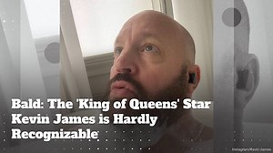 Bald: 'King of Queens' Star Kevin James is Hardly Recognizable!