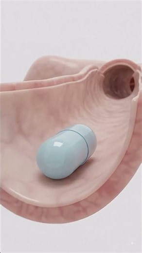 How Does a Baby Move Through the Birth Canal During Delivery? #pregnancy #medicalanimation