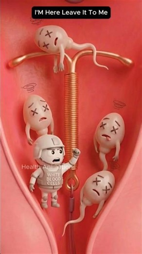 Women's Reproductive Health: The IUD Solution #health #animation #shorts